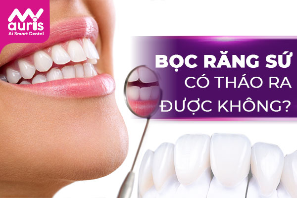 bọc răng sứ có tháo ra được không