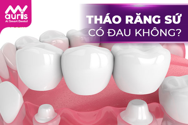 bọc răng sứ có tháo ra được không