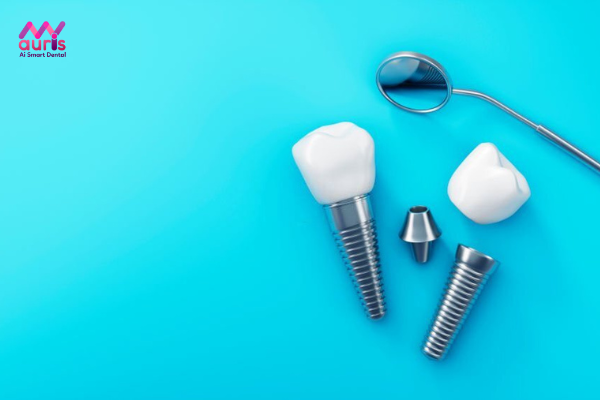 Cấy ghép răng Implant có đau không?