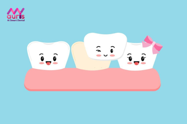Giải đáp câu hỏi: “Giá bọc răng sứ bao nhiêu tiền?”