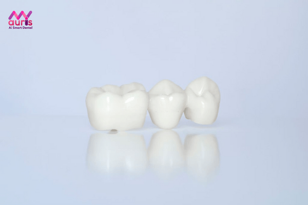 Những trường hợp không nên bọc răng sứ