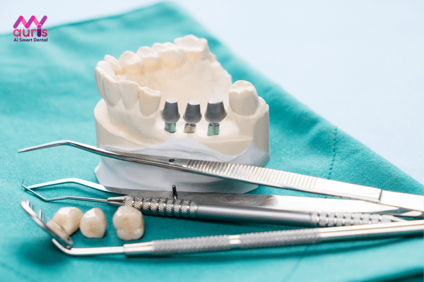 Kỹ thuật trồng răng implant có phức tạp không?