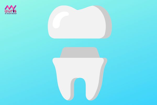 Phương pháp bọc răng sứ cho răng sâu là gì? có nên bọc răng sứ cho răng sâu