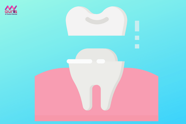 Phương pháp bọc răng sứ cho răng sâu như thế nào?