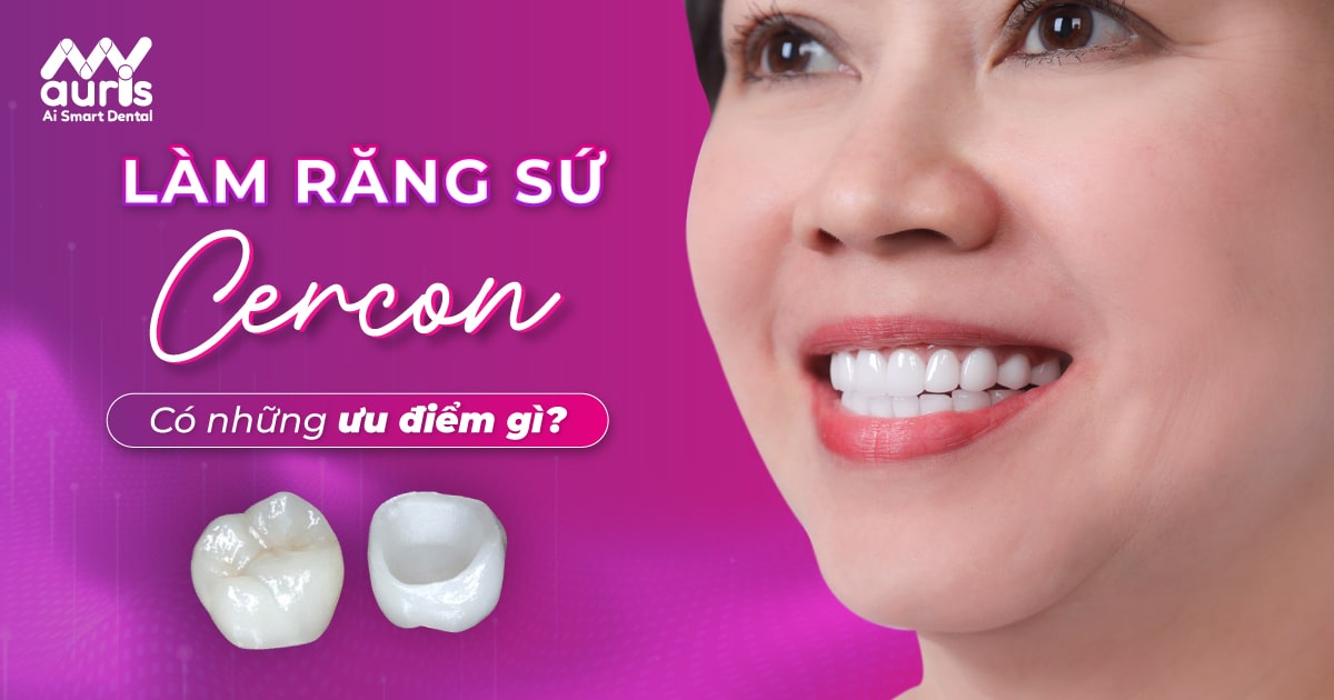 Làm răng sứ Cercon có tốt không với ưu điểm là gì?